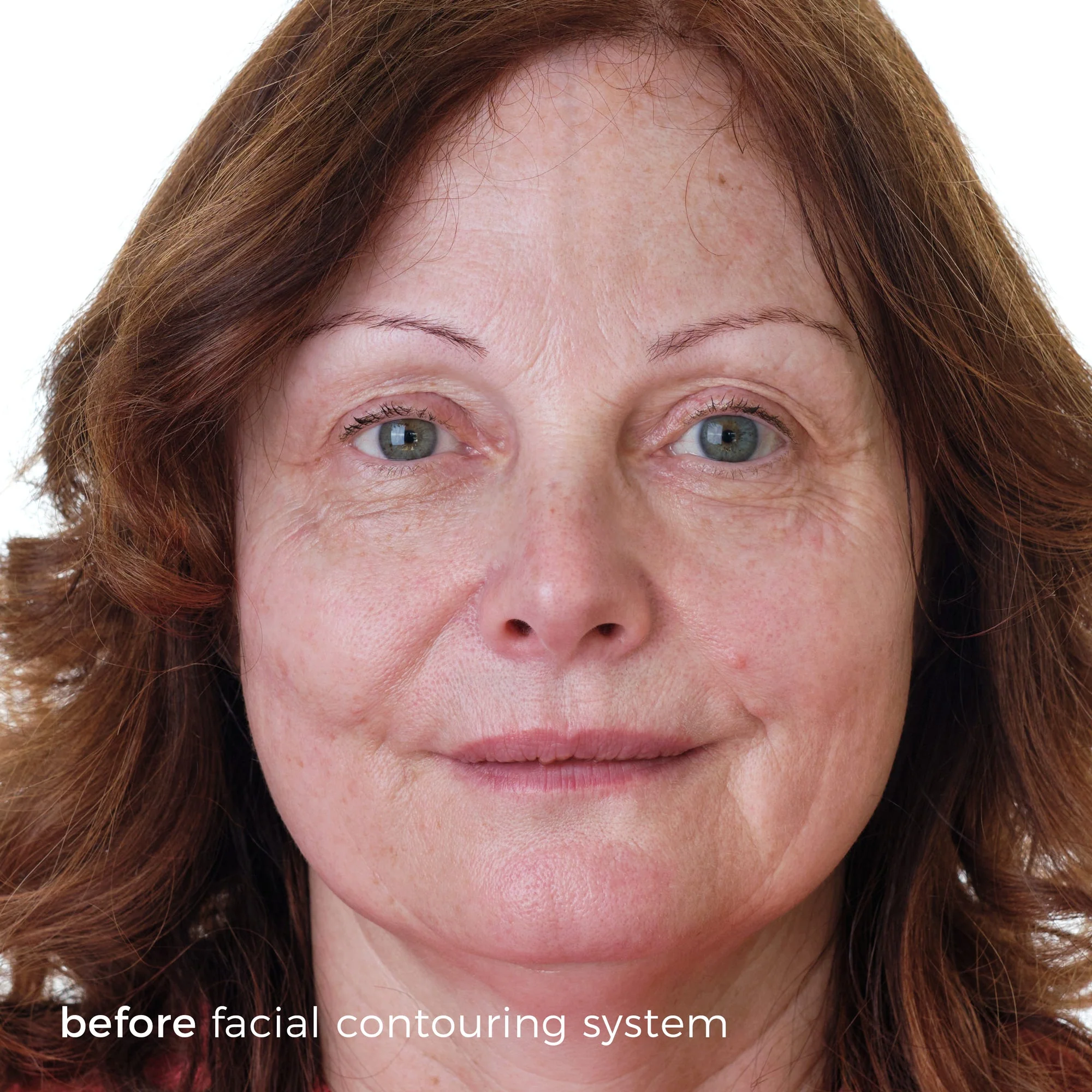 Skinbunny Facial Contouring System - Image 4
