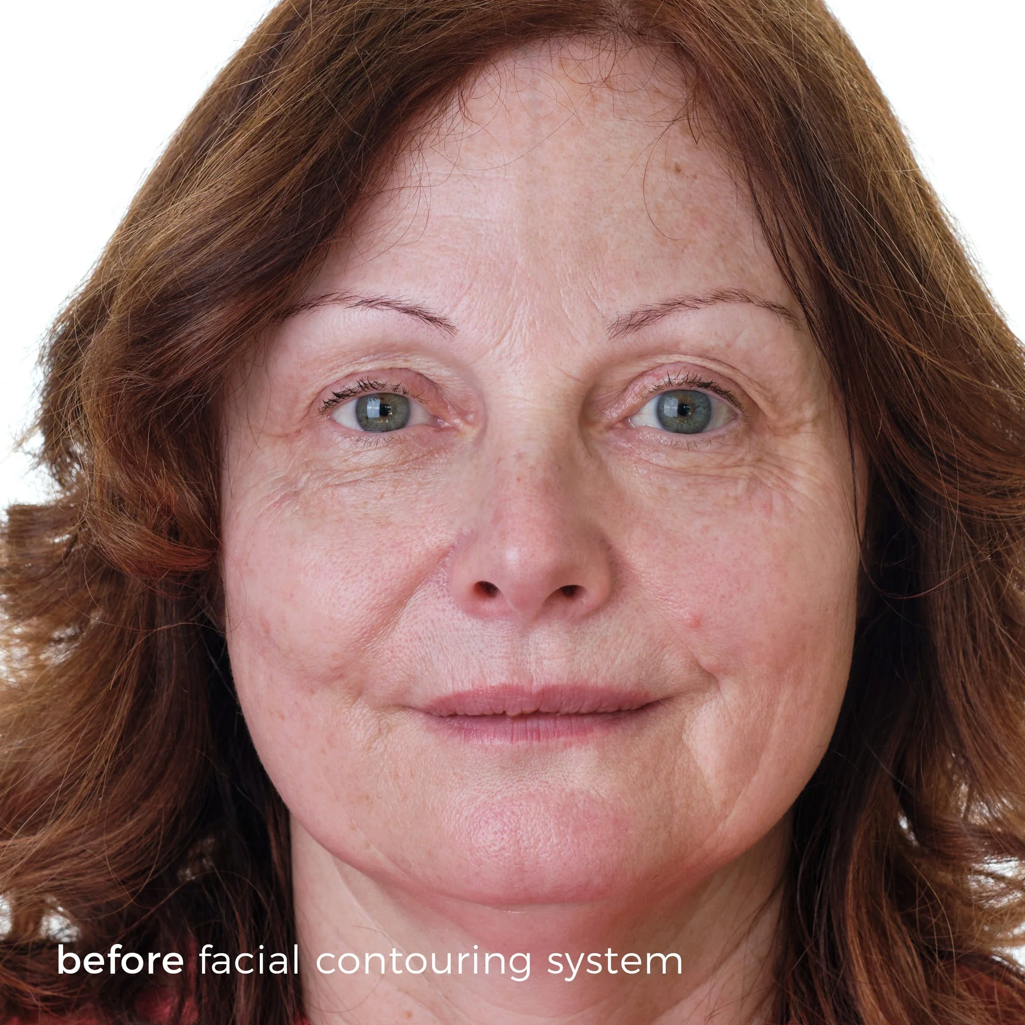 Skinbunny Facial Contouring System - Professional Pack 50 - Image 3