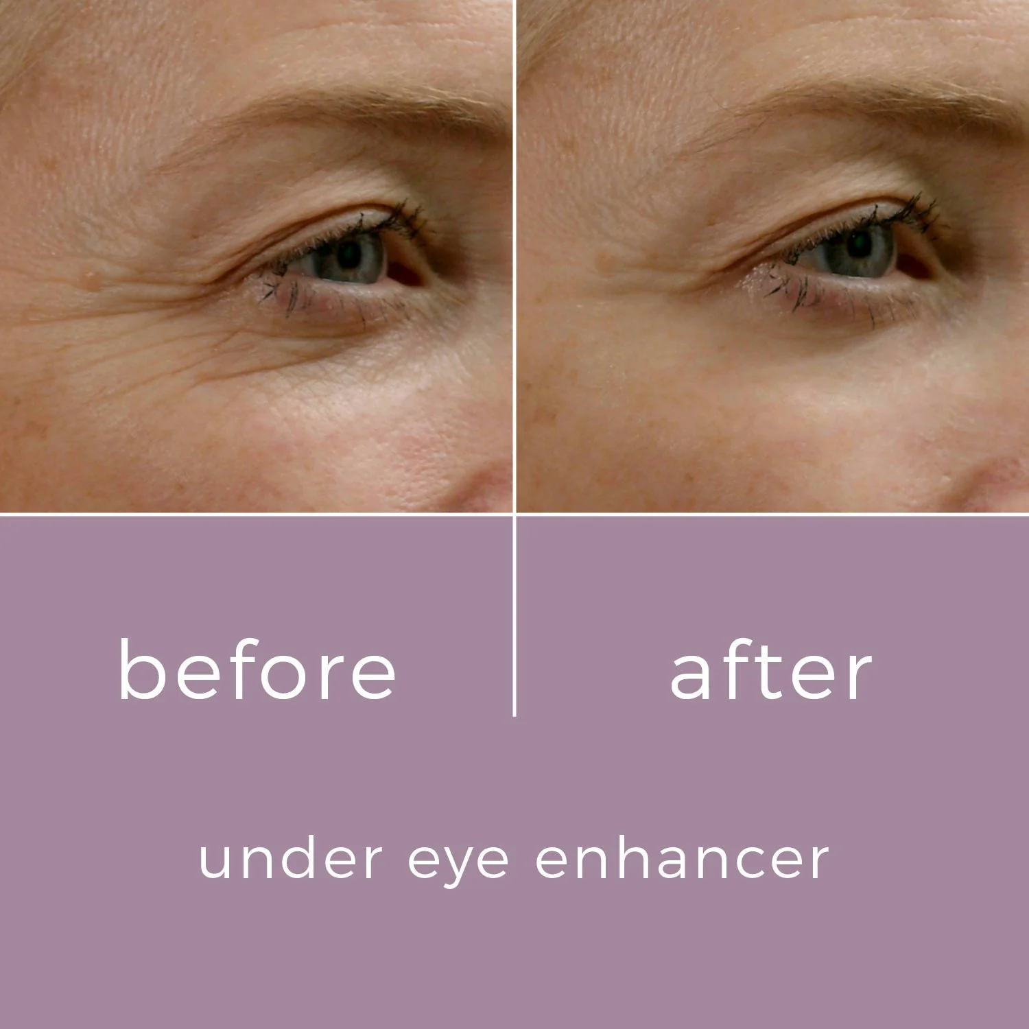 Skinbunny Under Eye Enhancer 100% extra absolutely FREE - Image 7