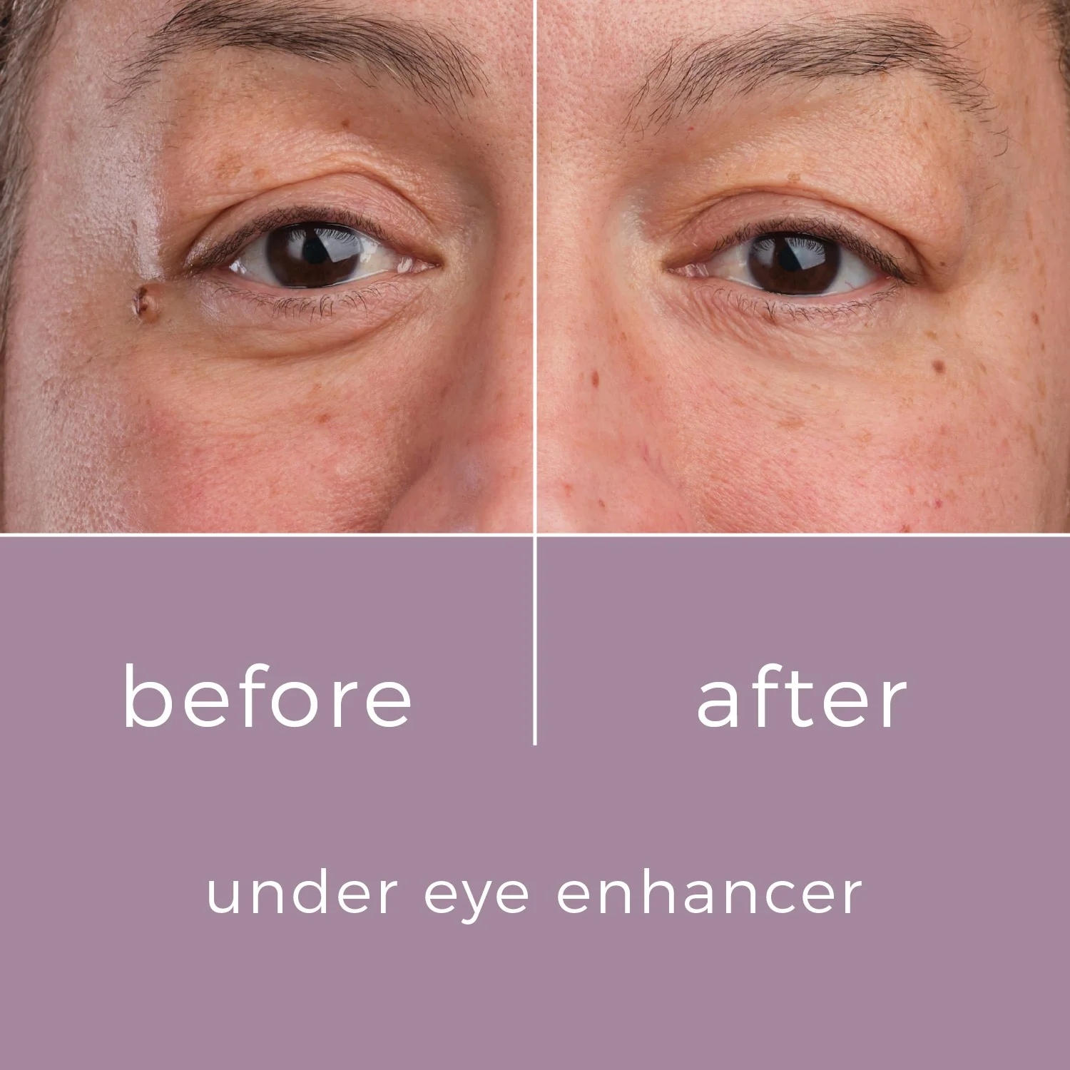 Skinbunny Under Eye Enhancer with Hyaluronic Acid Moisturiser - Image 8