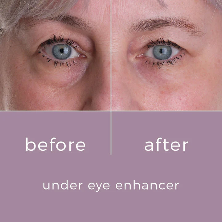 Skinbunny Under Eye Enhancer... Flash Sale - Image 6