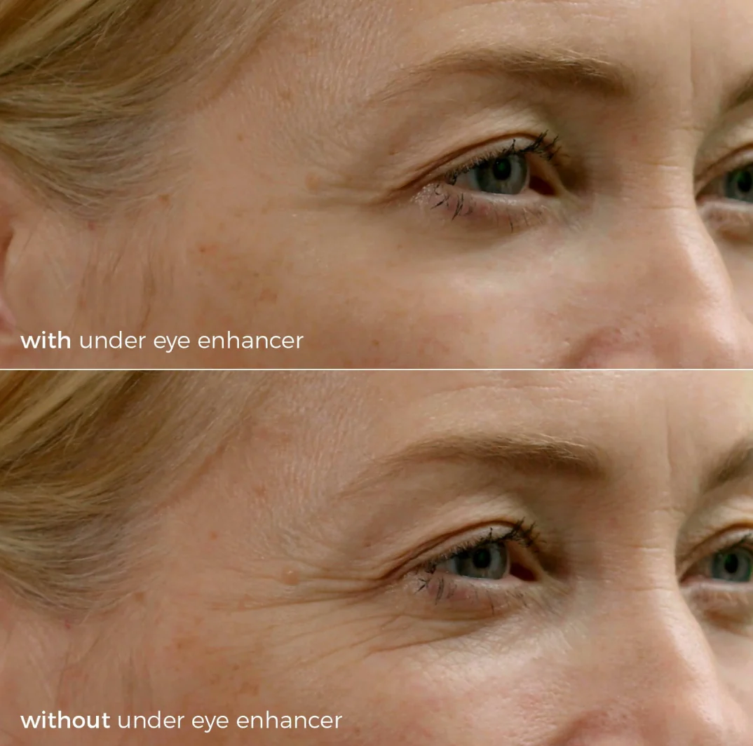 Skinbunny Under Eye Enhancer with Vitamin C Serum - Image 7