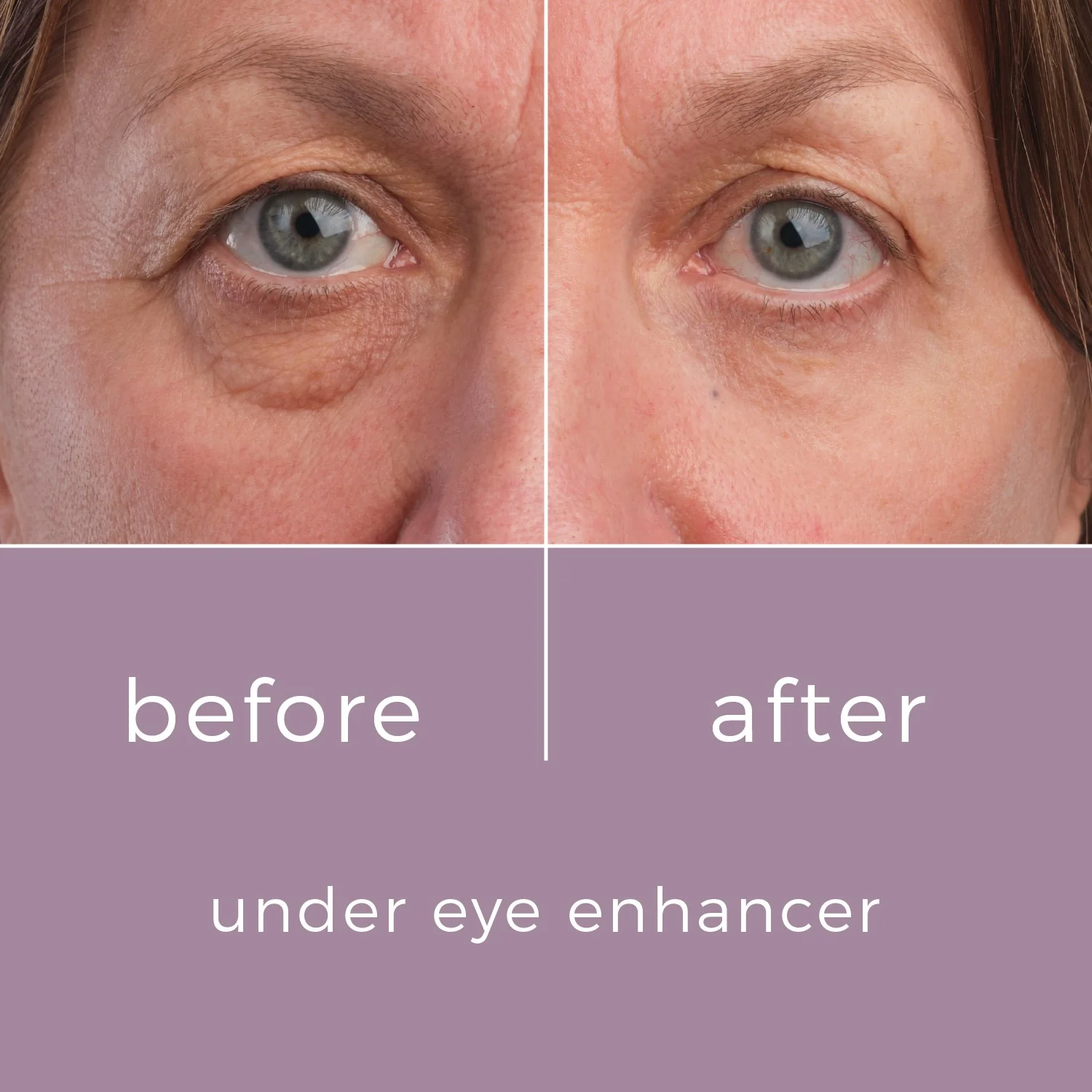 Skinbunny Under Eye Enhancer with Hyaluronic Acid Moisturiser - Image 4