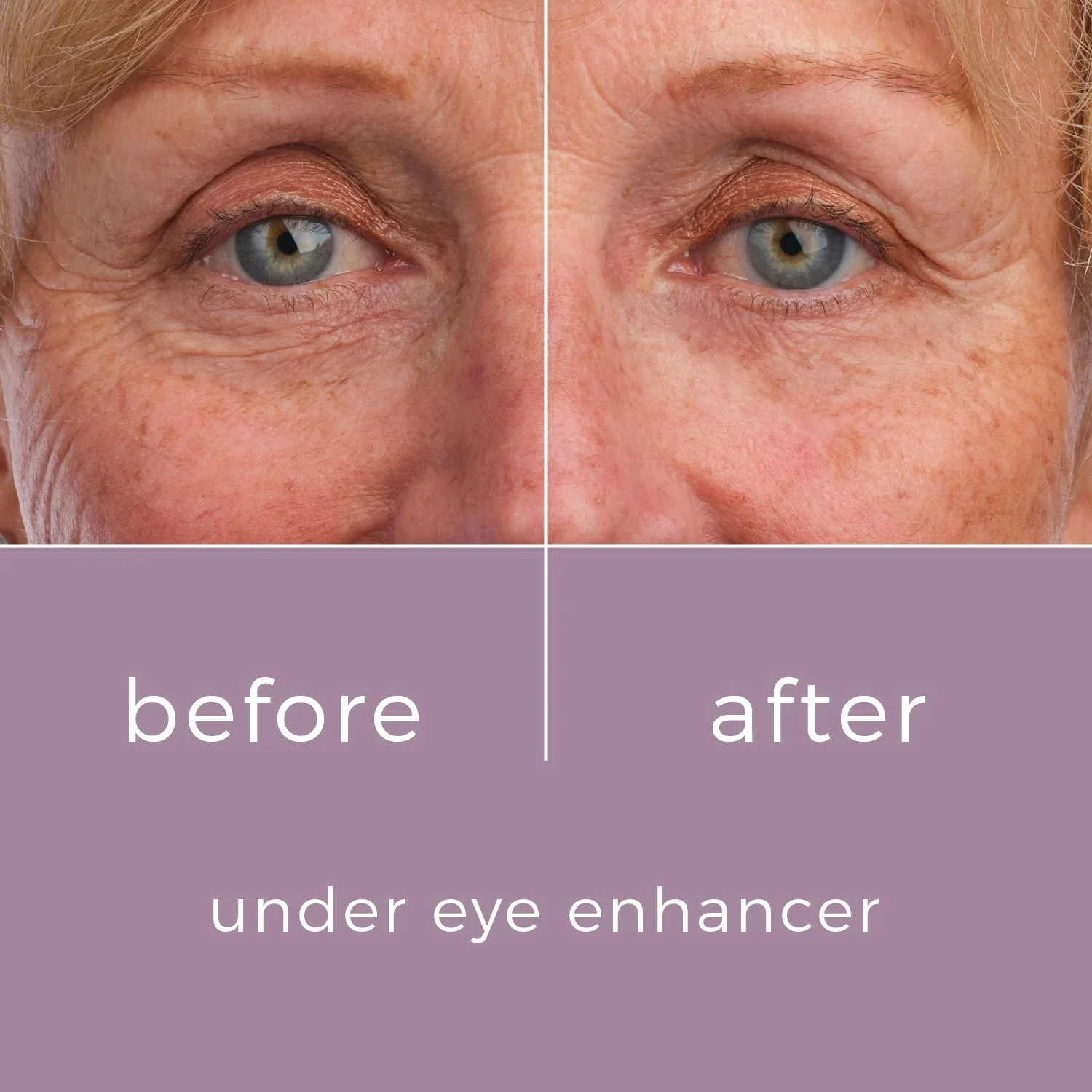 Skinbunny Under Eye Enhancer with Hyaluronic Acid Moisturiser - Image 5