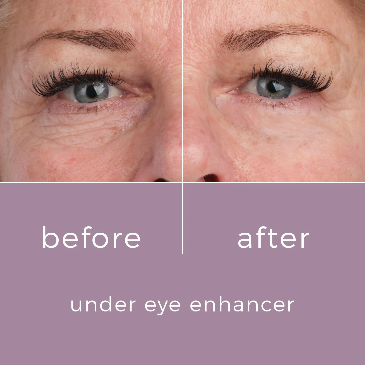 Skinbunny Under Eye Enhancer with Hyaluronic Acid Moisturiser - Image 7