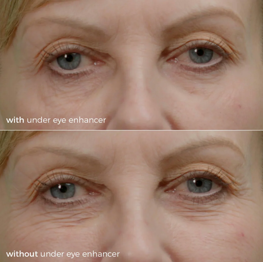 Skinbunny Under Eye Enhancer with Hyaluronic Acid Moisturiser FREE! - Image 3