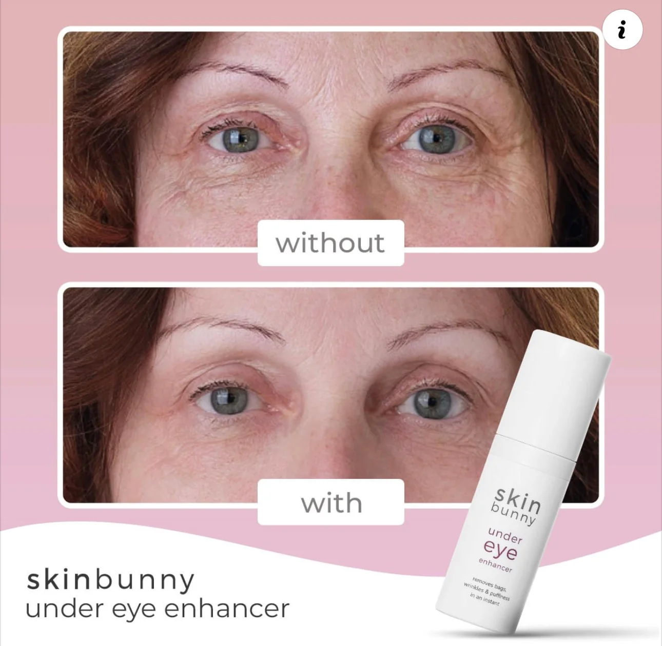 Skinbunny Under Eye Enhancer 200 & FREE Long Lasting Moisturiser - Image 2
